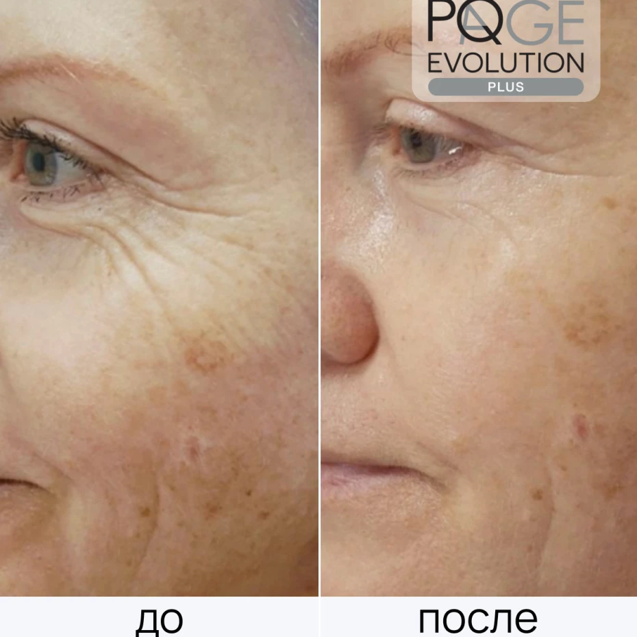 PQ Age Evolution Plus 1 ед.