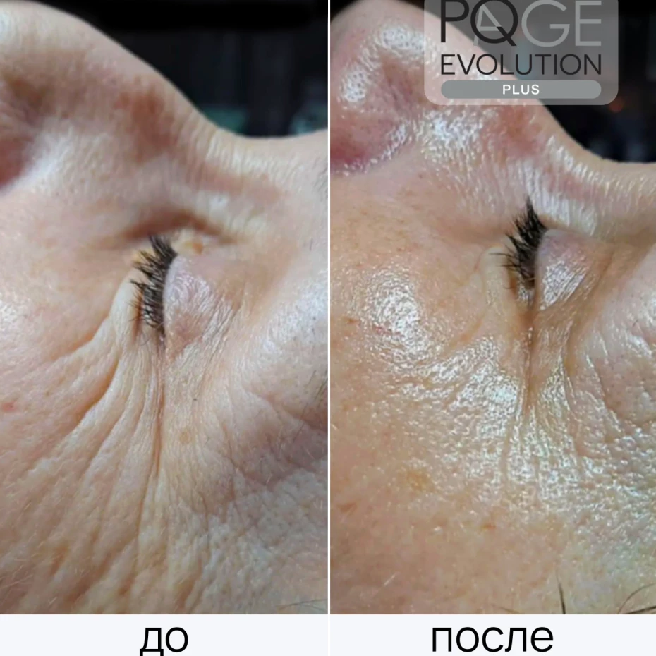 PQ Age Evolution Plus 1 ед.