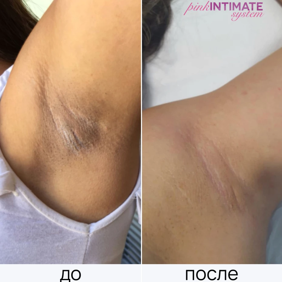 Pink Intimate System 1 ед.