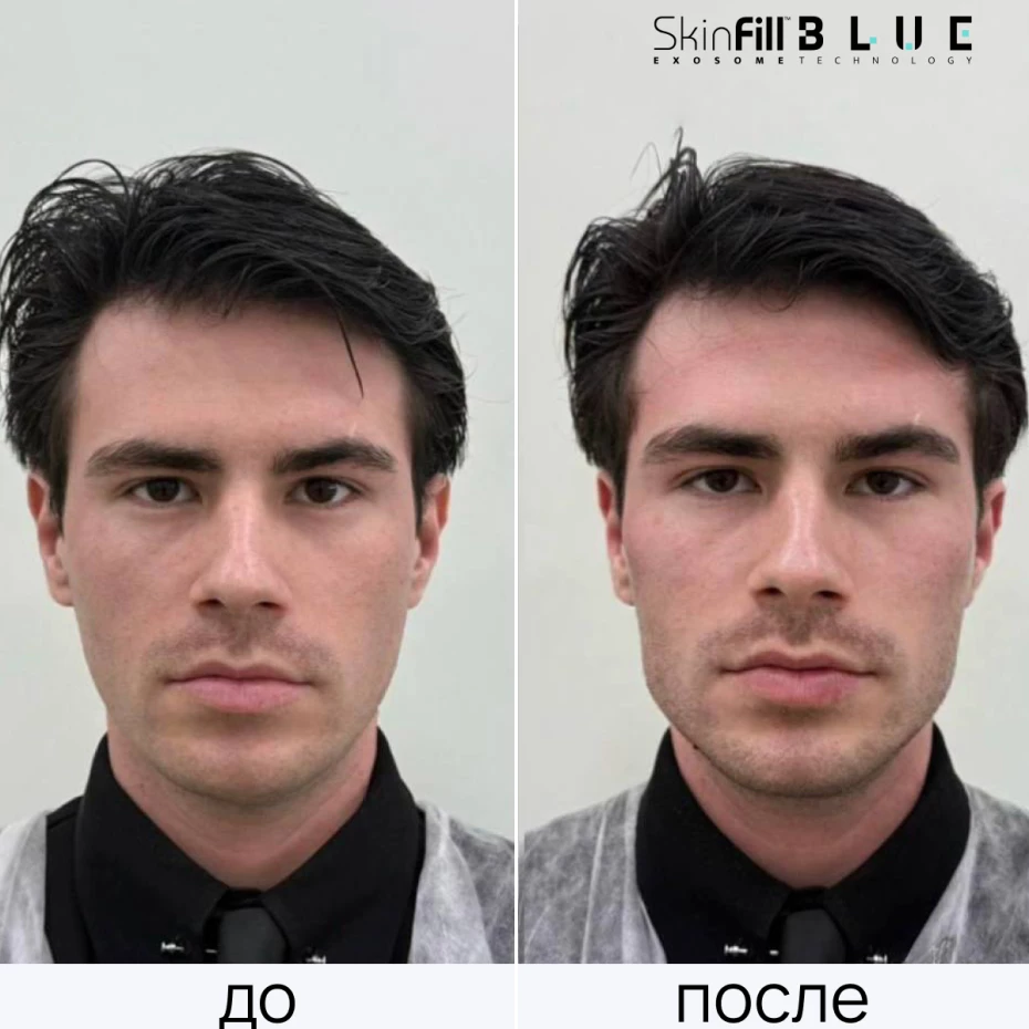 Экзобустер Blue